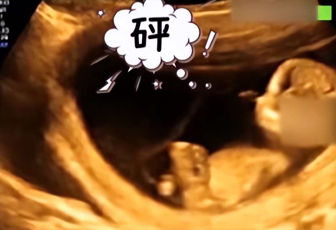 狂踢孕妇肚子的电视剧_孕妇被踢肚子疼视频_孕妇肚子被踢死视频