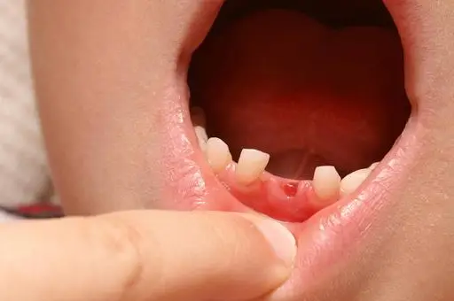 牙仙子视频_仙子牙大全图片卡通_牙仙子的图片大全