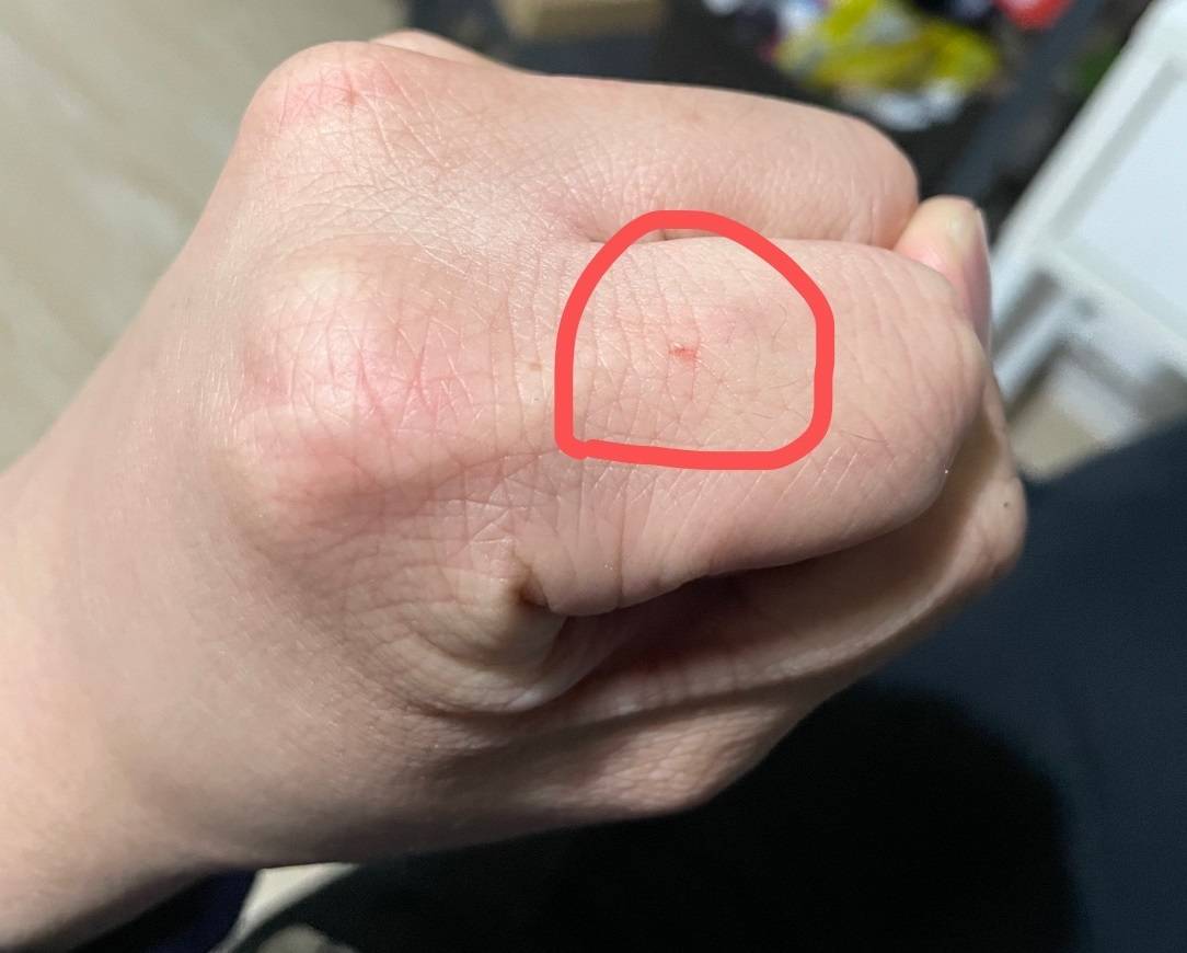 怎么抓流浪狗下的崽子_抓流浪狗有什么特效办法_抓狗流浪崽子下一句